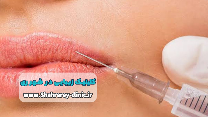 تزریق ژل و بوتاکس در شهر ری؛ راهکاری برای جوانسازی طبیعی